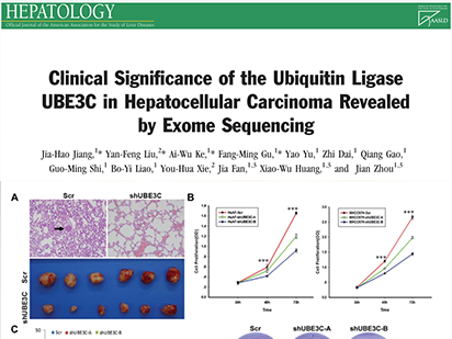 Jiang J, et al. Clinical Significance of the Ubiquitin Ligase UBE3C in Hepatocellular Carcinoma Revealed by Exome Sequencing. Hepatology. 2014 Jun;59(6):2216-27. (IF=12.003)