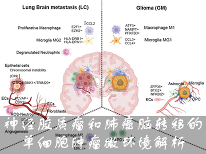 【烈冰助力】神经胶质瘤和肺癌脑转移的单细胞肿瘤微环境解析